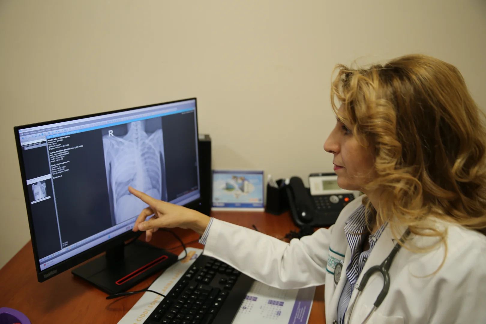 Akciğer kanserinde erken teşhis hayat kurtarıyor