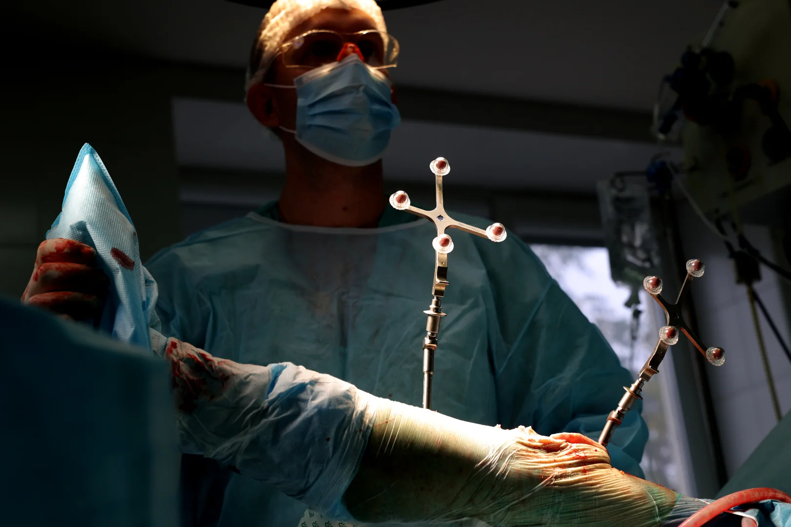 Sınır kent Belgorod'da kişiye özel protez ameliyatlar