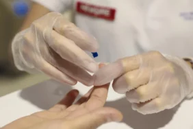 Mersin’de Belediye Personeline Şeker Ölçümü Yapıldı