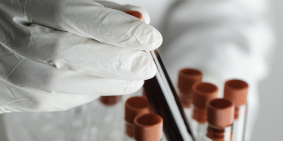 ‘Gençlik’ bu proteinlerde saklı olabilir… 100 yaşına ulaşmanın sırrı kanımızda mı?