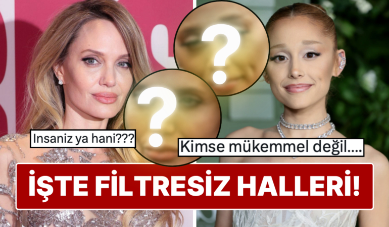 filtresiz-goruntuleri-ortaya-cikti-unlu-isimlerin-dogal-halleri-gundem-oldu-kRUEuCx6.jpg