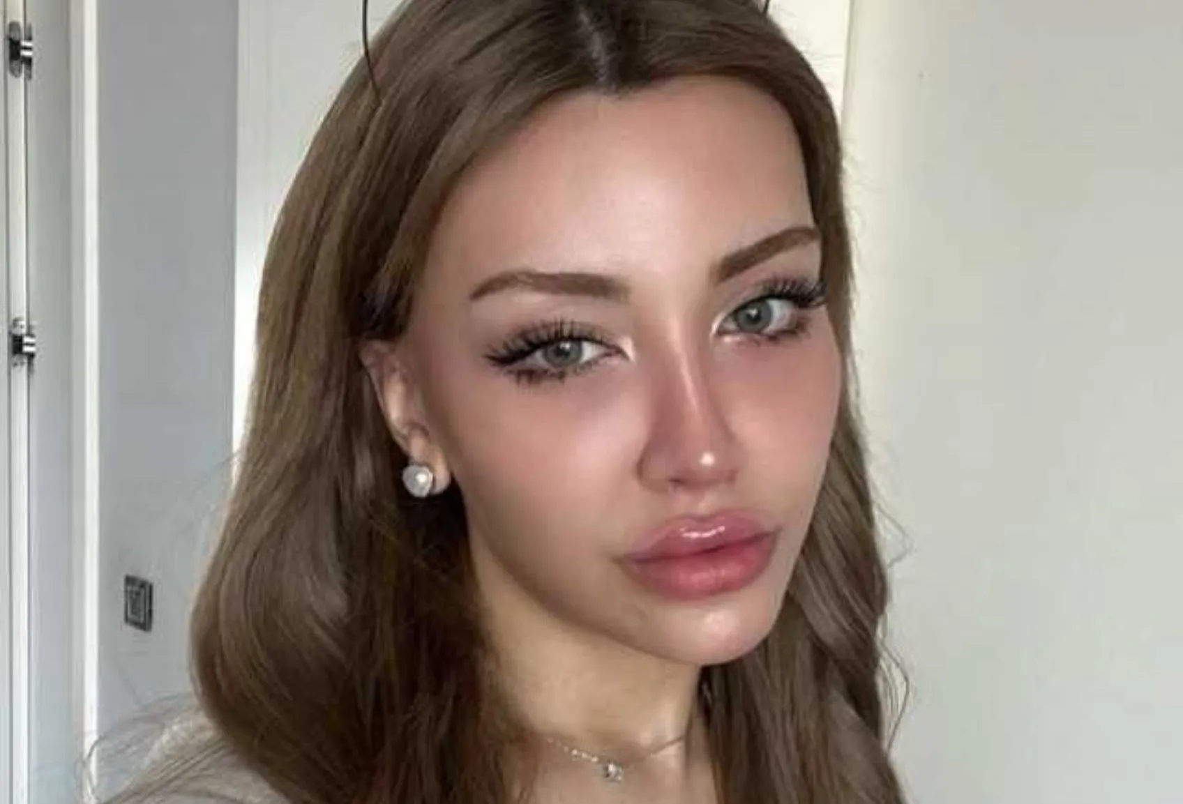 Mika Raun Gerçek İsmi Ne?