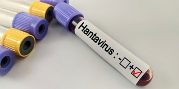 hantavirus-bir-salgina-donusur-mu-vctAwMmT.jpg